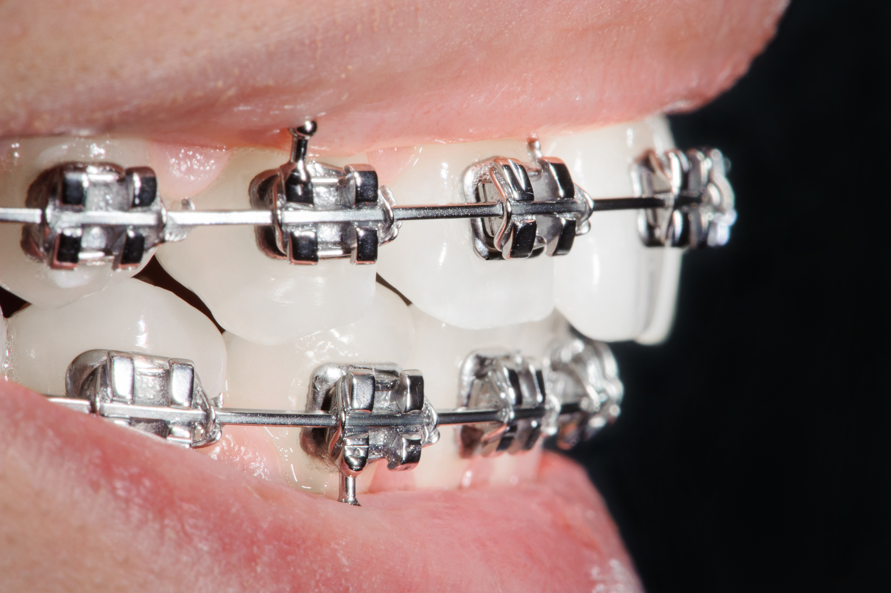Orthodontics 101