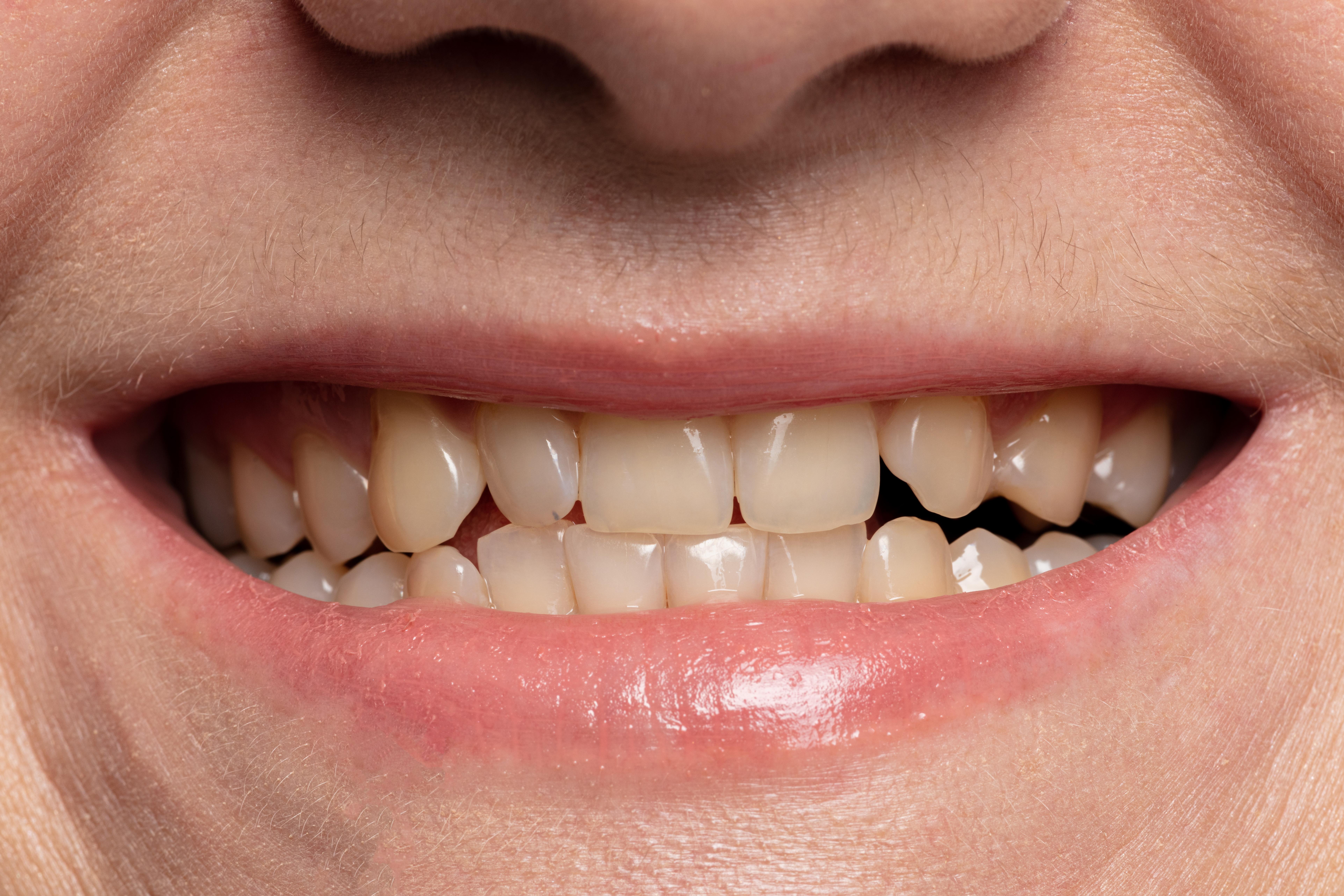 Occlusion: Multidisciplinary Approach